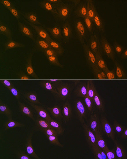 hnRNP Q/SYNCRIP Rabbit mAb