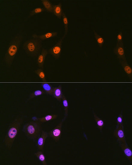 hnRNP Q/SYNCRIP Rabbit mAb