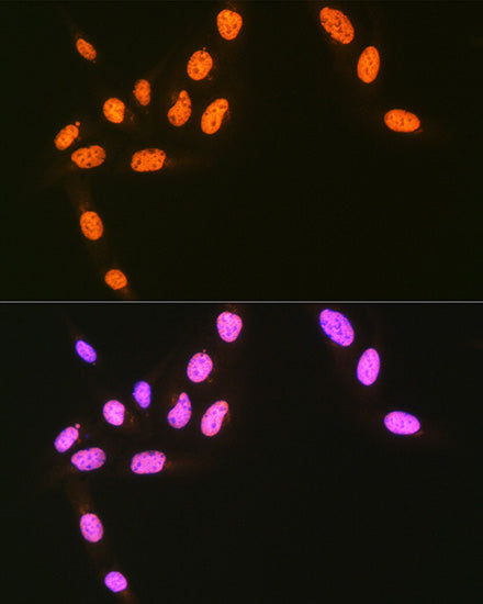 hnRNP Q/SYNCRIP Rabbit mAb