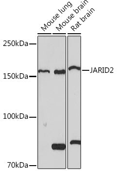 JARID2 Rabbit mAb