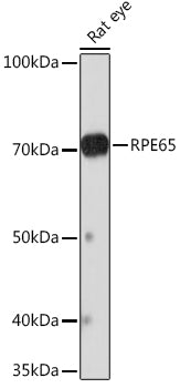 RPE65 Rabbit mAb