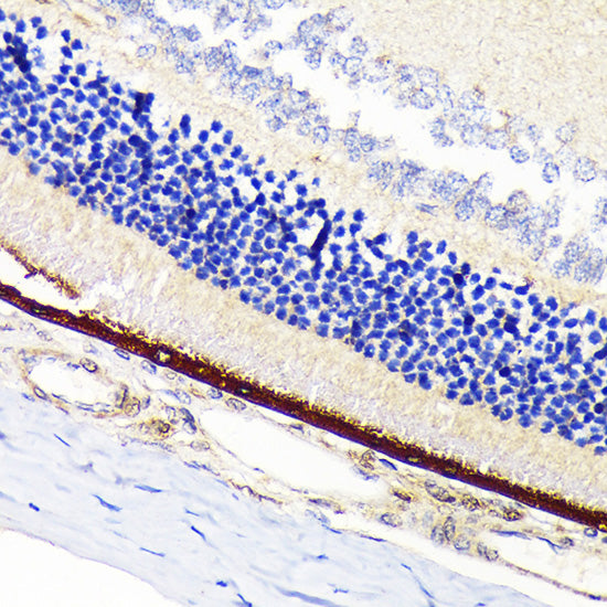 RPE65 Rabbit mAb