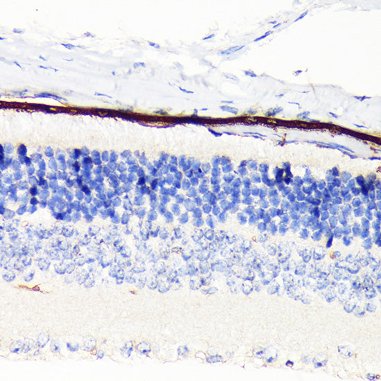 RPE65 Rabbit mAb