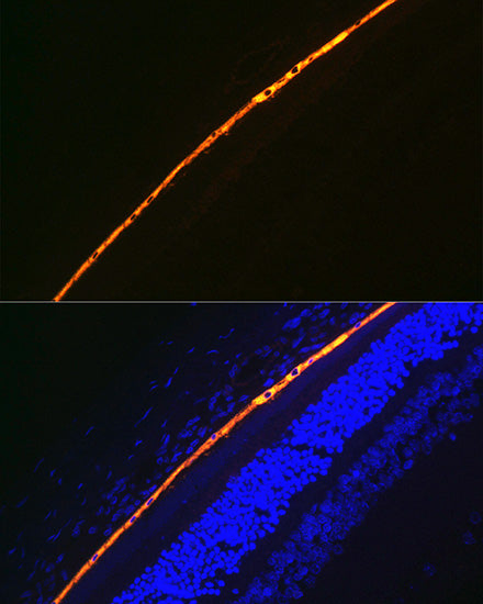 RPE65 Rabbit mAb