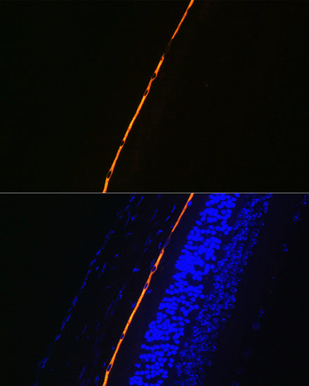 RPE65 Rabbit mAb