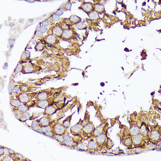 Nectin 2/CD112 Rabbit mAb