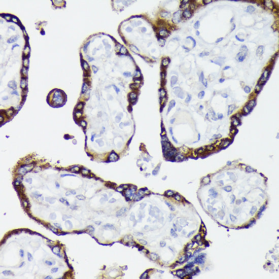 Nectin 2/CD112 Rabbit mAb