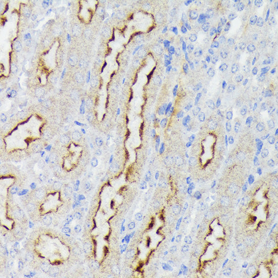 Nectin 2/CD112 Rabbit mAb