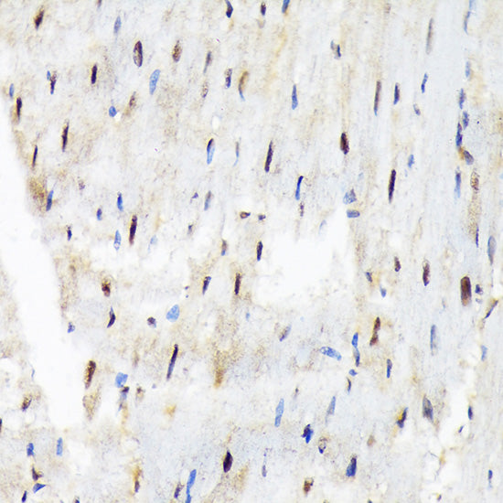 SF3B3/SAP130 Rabbit mAb