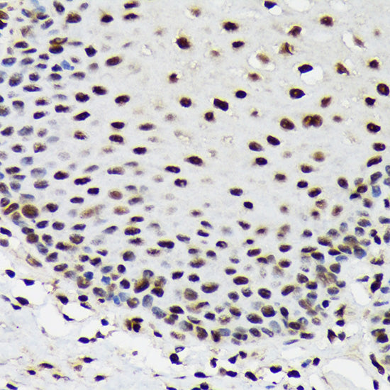 SF3B3/SAP130 Rabbit mAb