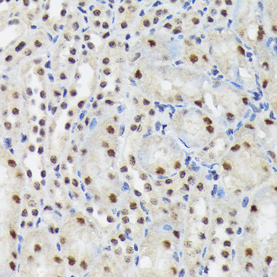 SF3B3/SAP130 Rabbit mAb
