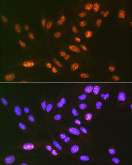 SF3B3/SAP130 Rabbit mAb