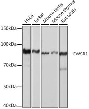 EWSR1 Rabbit mAb