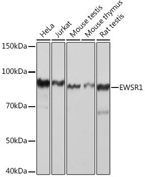 EWSR1 Rabbit mAb