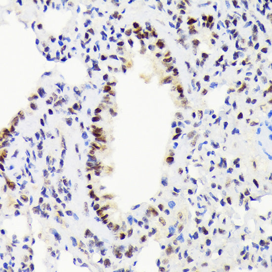EWSR1 Rabbit mAb