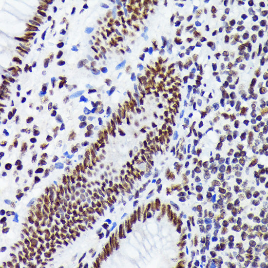 EWSR1 Rabbit mAb