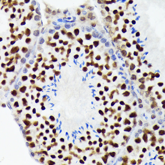 EWSR1 Rabbit mAb