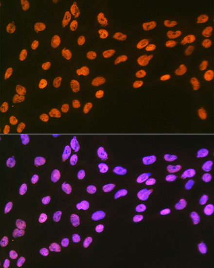 EWSR1 Rabbit mAb