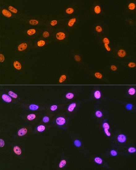 EWSR1 Rabbit mAb