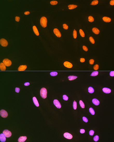 EWSR1 Rabbit mAb