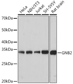 GNB2 Rabbit mAb