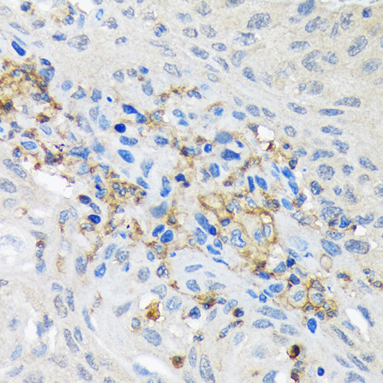 GNB2 Rabbit mAb