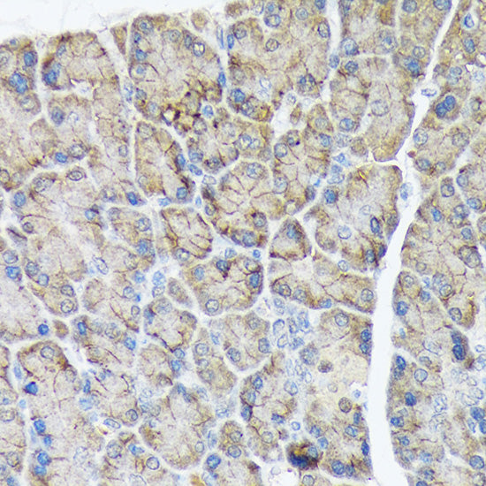 PLTP Rabbit mAb