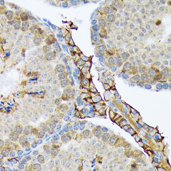PLTP Rabbit mAb