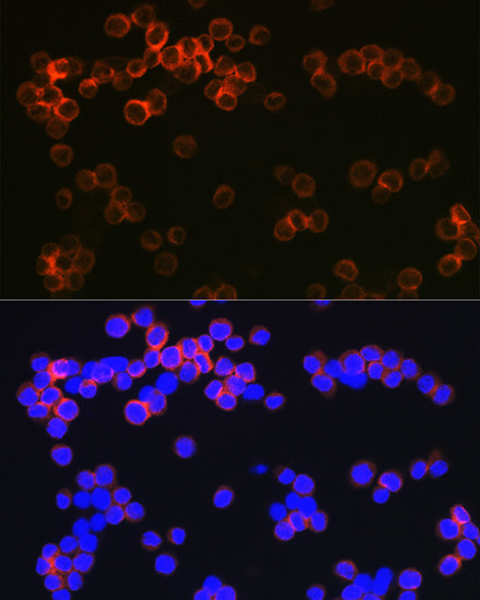 CD209 Rabbit mAb