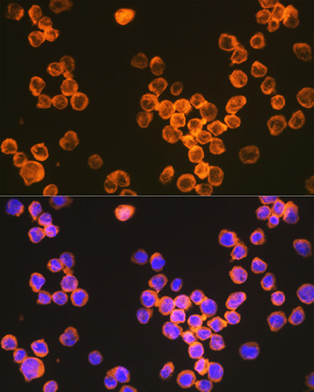 CD209 Rabbit mAb