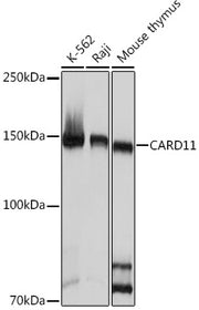 CARD11 Rabbit mAb
