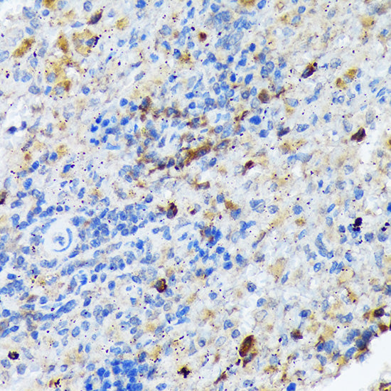 CARD11 Rabbit mAb