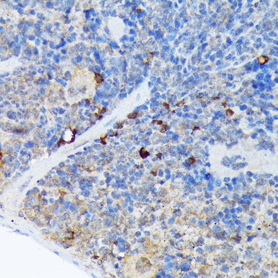 CARD11 Rabbit mAb