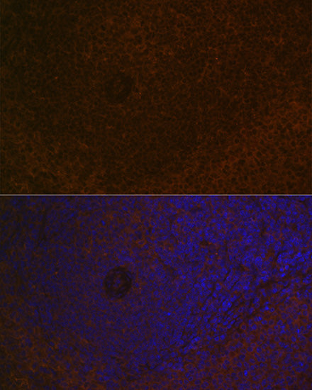 CARD11 Rabbit mAb
