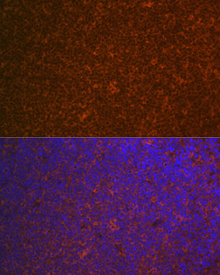 CARD11 Rabbit mAb