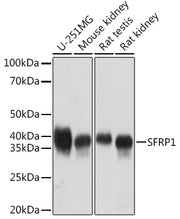 SFRP1 Rabbit mAb
