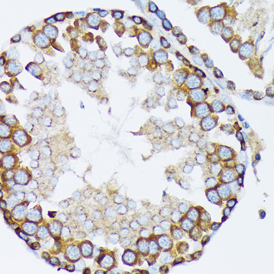 γ-Tubulin Rabbit mAb