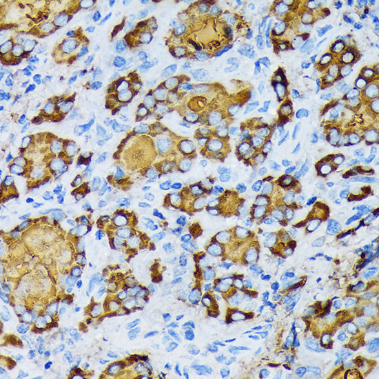 γ-Tubulin Rabbit mAb