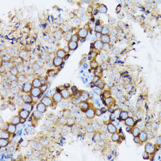 γ-Tubulin Rabbit mAb