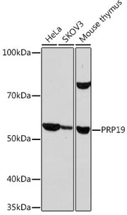 PRP19 Rabbit mAb
