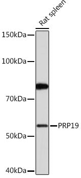 PRP19 Rabbit mAb