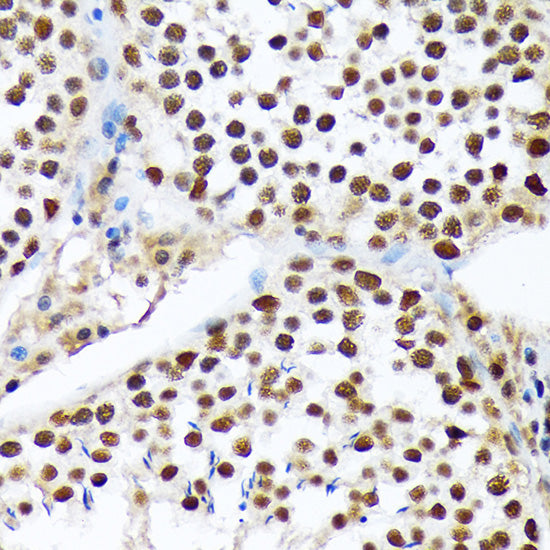 PRP19 Rabbit mAb