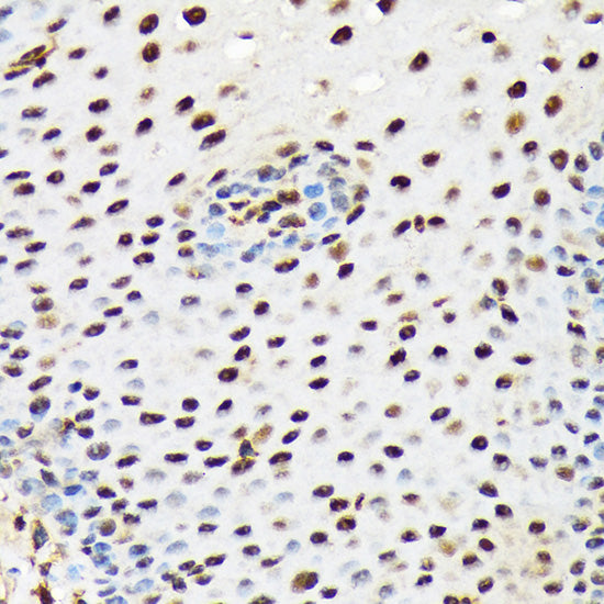 PRP19 Rabbit mAb