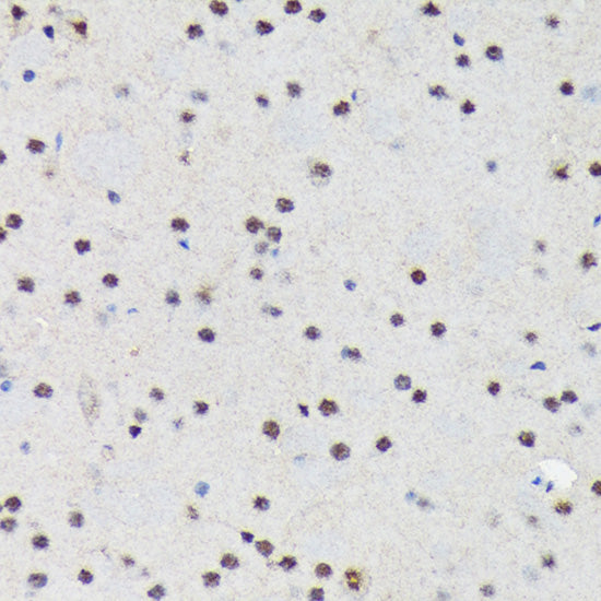 PRP19 Rabbit mAb