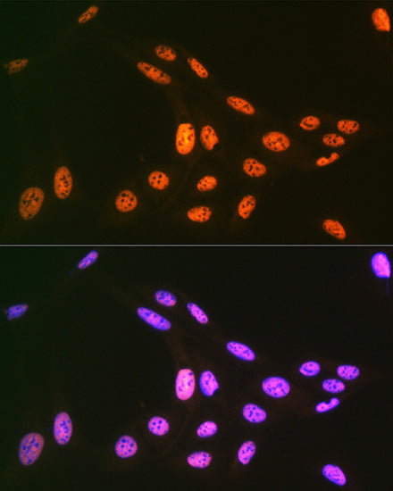 PRP19 Rabbit mAb