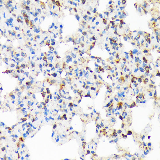 TIRAP Rabbit mAb