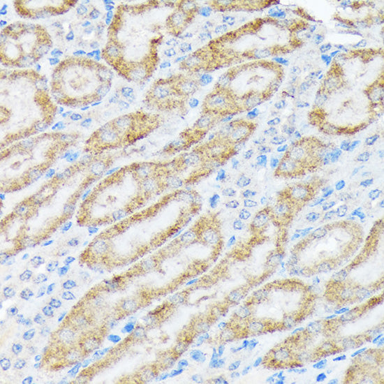 TIRAP Rabbit mAb