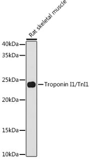 Troponin I1/TnI1 Rabbit mAb