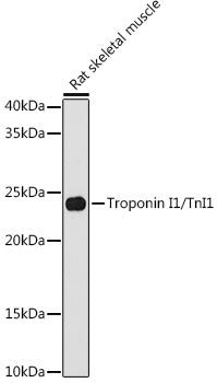 Troponin I1/TnI1 Rabbit mAb