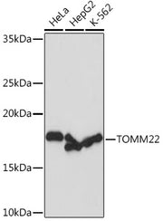 TOMM22 Rabbit mAb